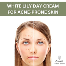 Load image into Gallery viewer, White Lily Organic Verbena Lightweight Day Cream for Acne &amp; Pimple Prone Skin, Skin Clearing Moisturizer for Face &amp; Neck, Made in Israel, 1.7 ounces