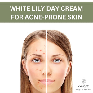 White Lily Organic Verbena Lightweight Day Cream for Acne & Pimple Prone Skin, Skin Clearing Moisturizer for Face & Neck, Made in Israel, 1.7 ounces