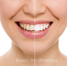 Load image into Gallery viewer, Teeth Whitening Kit 22% Carbamide Peroxide 10 Tooth Bleaching Gel Syringe Dispensers, 2 Moldable Dental Trays with Storage Case