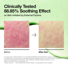 Load image into Gallery viewer, Anua Azelaic 10 Hyaluron Redness Soothing Pad, Troubled &amp; Spot Care with Korean toner pads, Quick &amp; Easy Stretchable Facial Mask with Azelaic acid, Hyaluronic Acid, Korean Skin Care (90 pads)