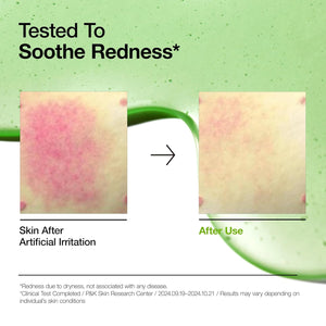 Anua Ultimate Spot Duo, Niacinamide 10 + TXA 4 Serum & Azelaic Acid 10 Hyaluron Redness Soothing Serum, Early & Post Spot Care, Skin Clarifying, Natural Color, Korean Skincare Set