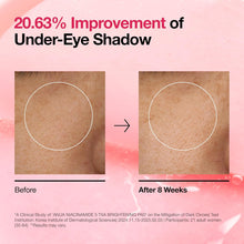 Load image into Gallery viewer, Anua Niacinamide 5 TXA Toner Pads – Hydrating Facial Pad for Even-Looking Skin Tone &amp; Daily Radiance Care, Glow up Under-Eye with Tranexamic Acid, Korean Skin Care (210ml, 60 Pads)