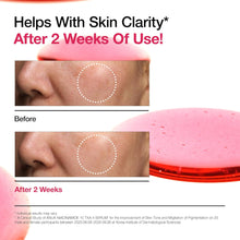 Load image into Gallery viewer, Anua Ultimate Glow Protection Duo, Zero-Cast Moisturizing Finish Sunscreen + Niacinamide 10 + TXA 4 Serum, SPF 50,No White Cast, Facial Serum for face, Korean skincare Set