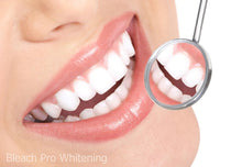 Load image into Gallery viewer, Teeth Whitening Kit 22% Carbamide Peroxide 10 Tooth Bleaching Gel Syringe Dispensers, 2 Moldable Dental Trays with Storage Case