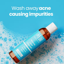 Load image into Gallery viewer, Zombie Acne Kit - Korean Skin Care Treatment for Acne Prone Skin - Rapid Action Salicylic Acid, Tea Tree &amp; Clove For Even Skin Tone