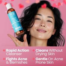 Load image into Gallery viewer, SeoulCeuticals Korean Acne Snail Cleanser Face Wash - Snail Mucin, Salicylic Acid &amp; Tea Tree Acne Treatment for Sensitive Skin &amp; K Beauty Glow 4oz