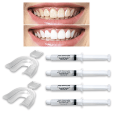 Load image into Gallery viewer, 4 Always White Teeth Whitening 22% Gel Syringes! + 2 Free Thermoformin