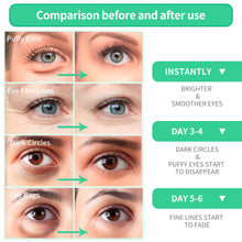 Load image into Gallery viewer, BREYLEE Aloe Vera Eye Mask– 60 Pcs - Under Eye Bags Treatment, Under